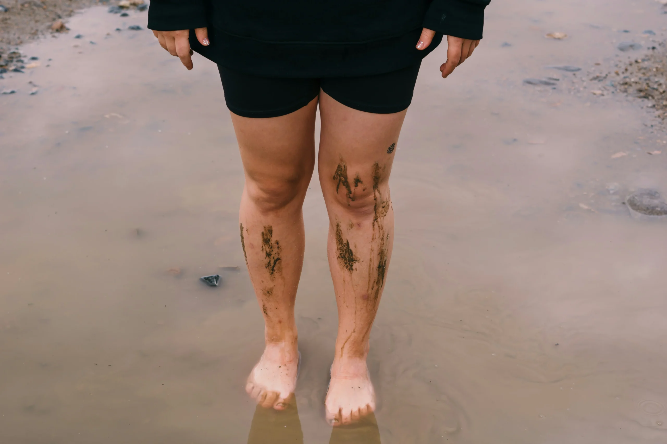 why is only my left leg swelling