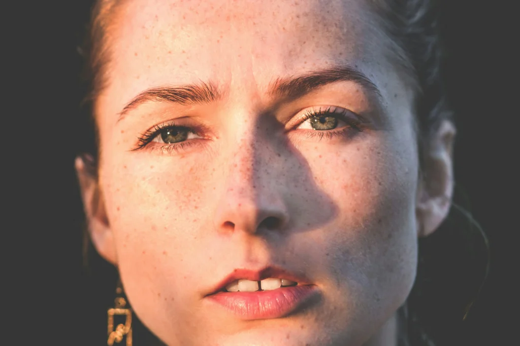 Blefaroplastia Precio Chile – Everything You Need to Know
