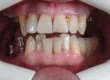 Why are my teeth yellow when i brush them everyday